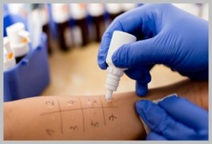 ALLERGOLOGIA
