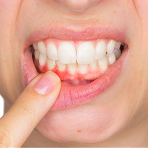 Dentista Sesto San Giovanni